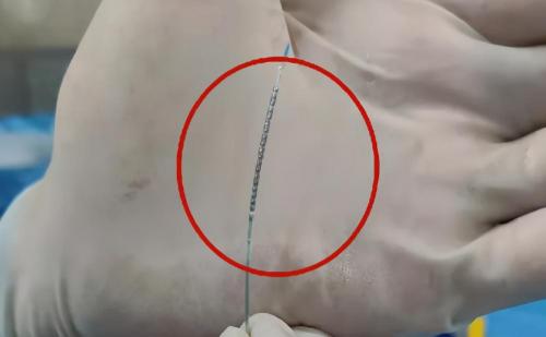 进口支架多少钱（澄清误解）