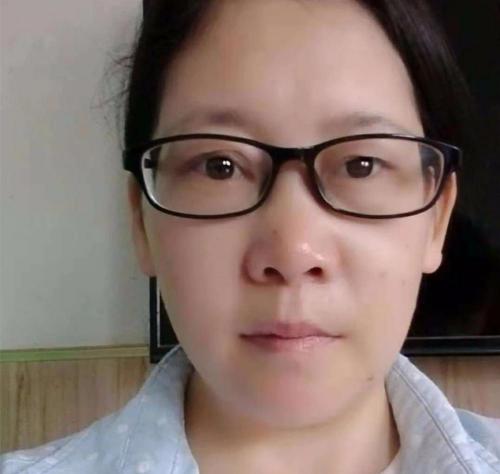 义眼片要多少钱（因为单眼失明拿不到教师资格证）