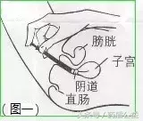 克霉唑栓多少钱一盒（每日一药）