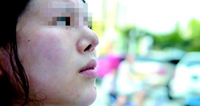 假体隆鼻整形多少钱（90后女子贷款3）