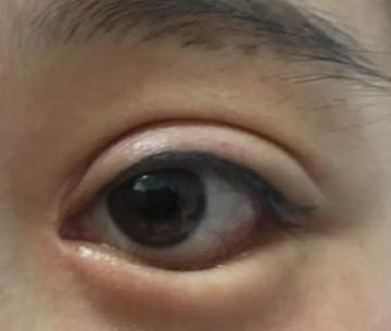 男士隆鼻多少钱永久的（为了让自己看起来温婉又楚楚可怜）