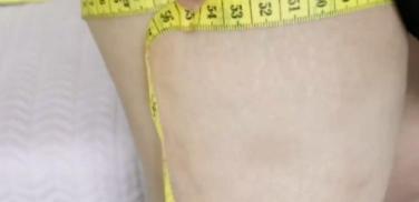 大腿根部抽脂多少钱（3万8抽脂后诊断血栓）