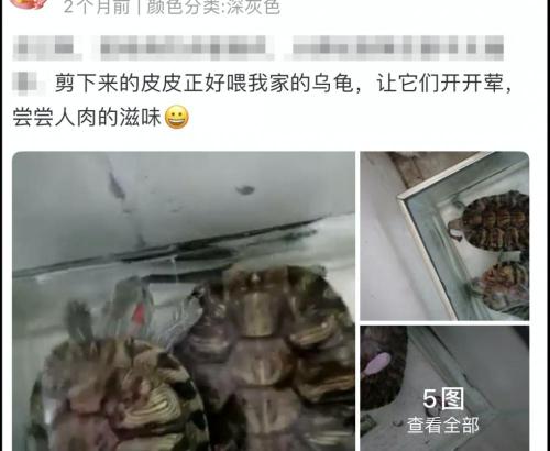 男生割包皮多少钱（割包皮也能自己动手）