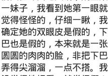 垫下巴的多少钱（整容是什么体验）