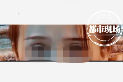 眼部抽脂多少钱（女子在南昌）