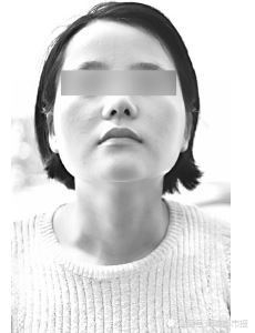 口腔美容多少钱（在泉州东大医疗美容门诊部）