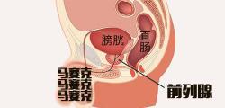 前列腺炎治疗需要多少钱（一般前列腺炎治多久才好）