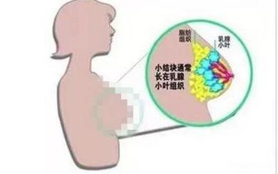 做一个全身检查需要多少钱（检查出来的一些病根本不需要担心）