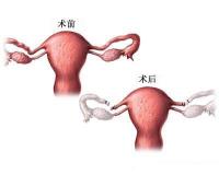 女性结扎手术多少钱（你结扎了吗）