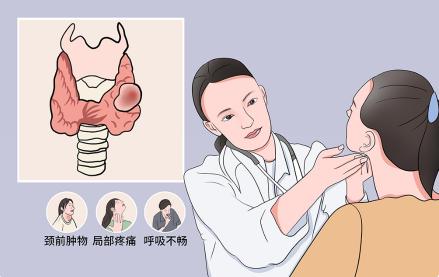 甲状腺囊肿手术多少钱（甲状腺疾病）
