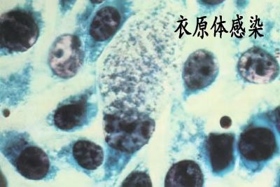男性支原体检查多少钱（都安全小黄盒）