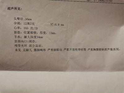产检糖耐多少钱（6万孕期检查厚如书）