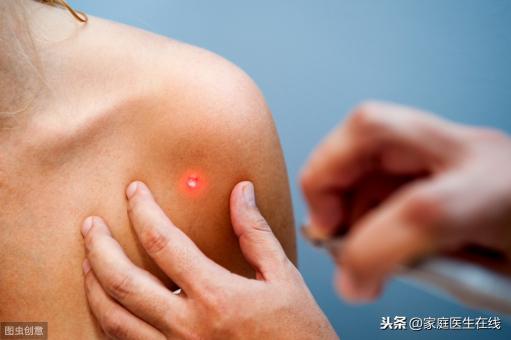 去脸上的痣多少钱一颗（脸上哪些痣是可以点掉的）
