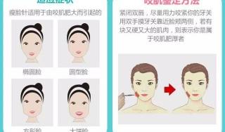 方脸打瘦脸针一般多少钱（悠兰科普七）