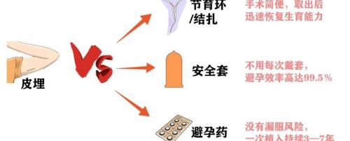 避孕埋线多少钱（皮下埋植避孕避孕是好方法吗）