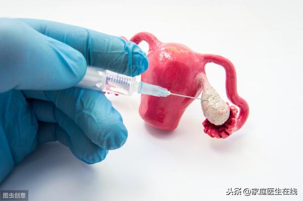 多囊卵巢微创手术价格（如何治疗多囊卵巢综合症）