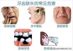 全口义齿价格（缺牙后2个结果难承受）