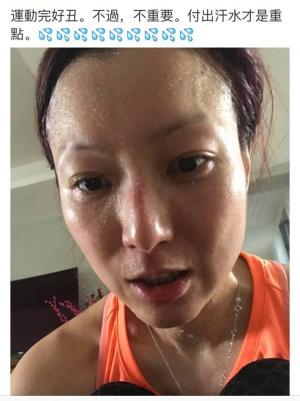 深圳治疗狐臭要多少钱（被出汗掩盖的疾病）