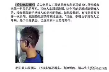 人工耳蜗手术价格（北京全城寻找价值20万的人工耳蜗）
