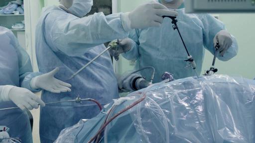 腹腔镜手术价格表（腹腔镜手术听得多了）