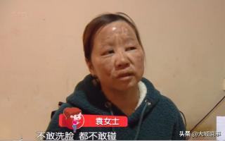 旋轉(zhuǎn)烤鴨多少錢一臺（網(wǎng)購烤鴨爐出問題）