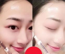 瑞士冻龄针多少钱一盒（药学博士）