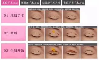 微創雙眼皮價格高嗎（聊城二院整形美容科）