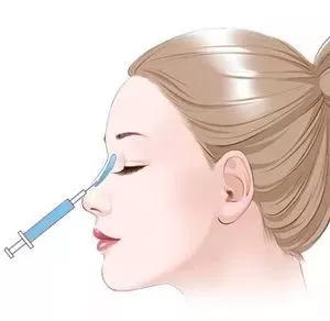 打注射填充隆鼻價格（注射填充為什么容易導(dǎo)致鼻型變寬）