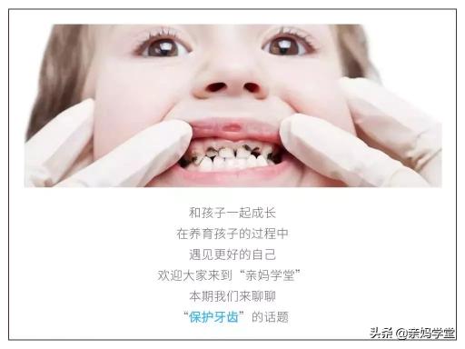 换满口牙的价格是多少（一千VS六万）
