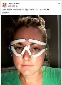 青光眼激光手术价格是多少（被激光近视手术）