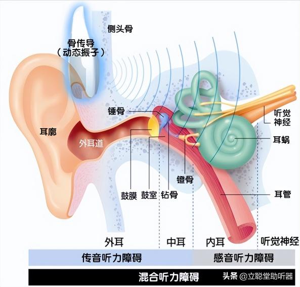 助聽器品牌價格（助聽器款式有哪些）