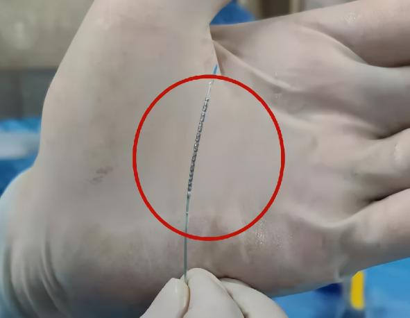 进口支架价格（澄清误解）
