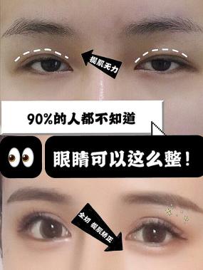 整形眼部价格（关医生整形功课）
