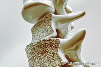 双能x线骨密度检查价格（吃氨糖）