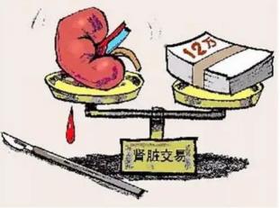 人体器官价格（人体器官）