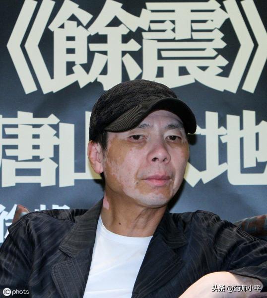 治疗白殿疯价格（辟谣）