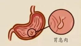 乌梅僵蚕丸价格（息肉）