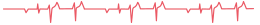 拉萨洗浴中心全套价格（去西藏旅游）