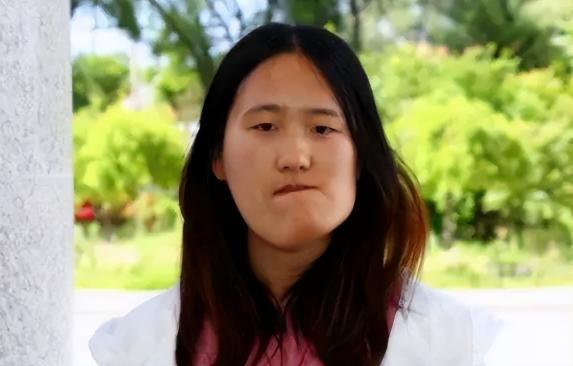 杏林整形医院价格表（辽宁歪脸女孩）