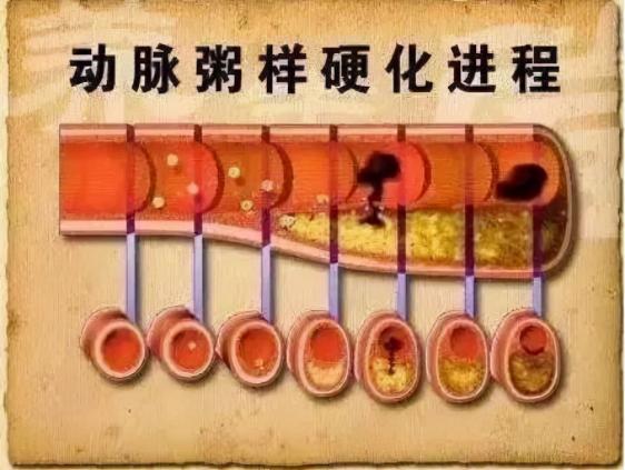 红曲灵芝丹参胶囊价格（3种中成药）