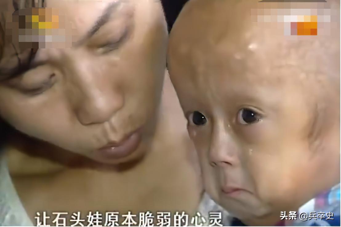 石頭的皮膚價格（2014年）