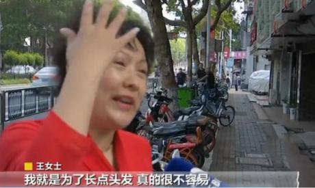 毛發種植 價格（女子花42000元植發）