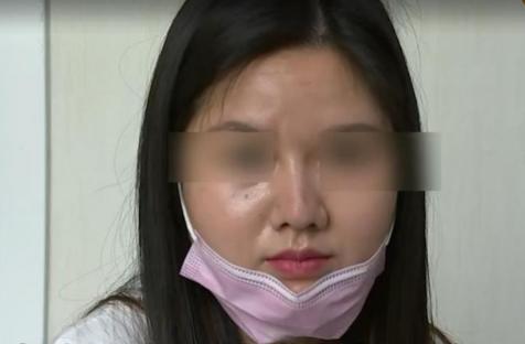 缩减鼻翼多少钱（花4万5整鼻子）