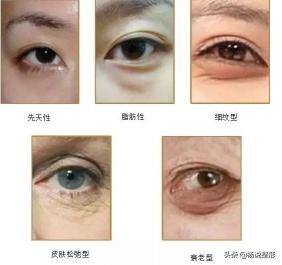无痕祛眼袋一般多少钱（如何去眼袋）