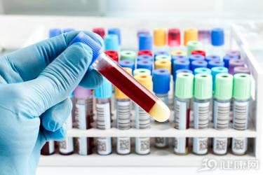 肝功能抽血检查多少钱（肝功能化验单看不懂）