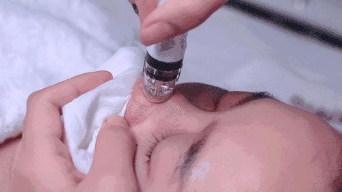 医院收缩毛孔多少钱（美容院做一次毛孔深层清洁几百块到底值不值）
