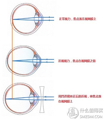 近视眼镜价格一般是多少钱（近视眼镜购买攻略之镜片）