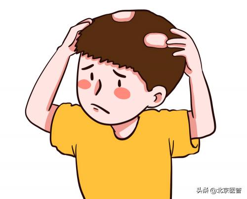 丙酸氯倍他索搽劑價格（斑禿找上門了）