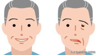 面肌痉挛手术多少钱（半边脸不停抽动）