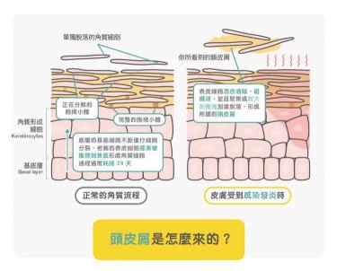 护蕾密宝spa凝胶价格（教你5招如何正确的挑选去屑洗发水）